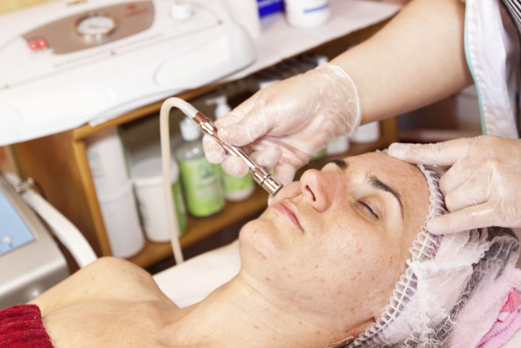 Microdermabrasion facial treatment - AZD Makeup & Skin Inc